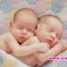 14-годишна от Сливен роди сиамски близнаци