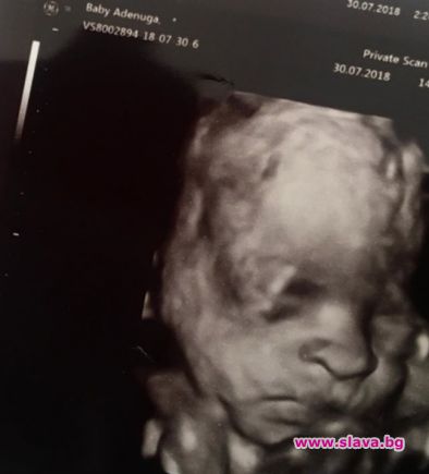 Изтече ултразвукова снимка на бебето на Наоми Кембъл