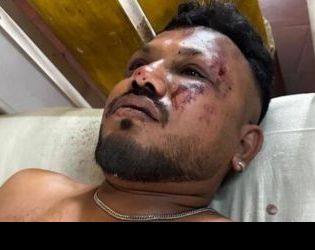 Чудо на седалка 11А: какво знаем за единствения оцелял в катастрофата на Air India Вишваш Кумар 